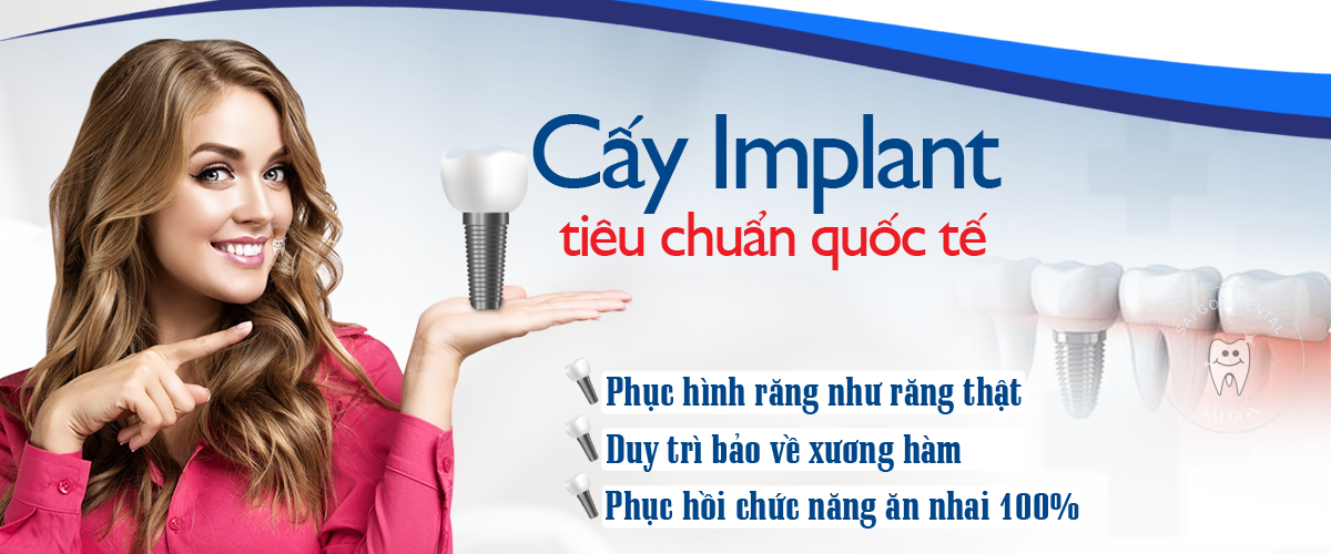 Địa chỉ trồng Implant uy tín tại Bình Dương