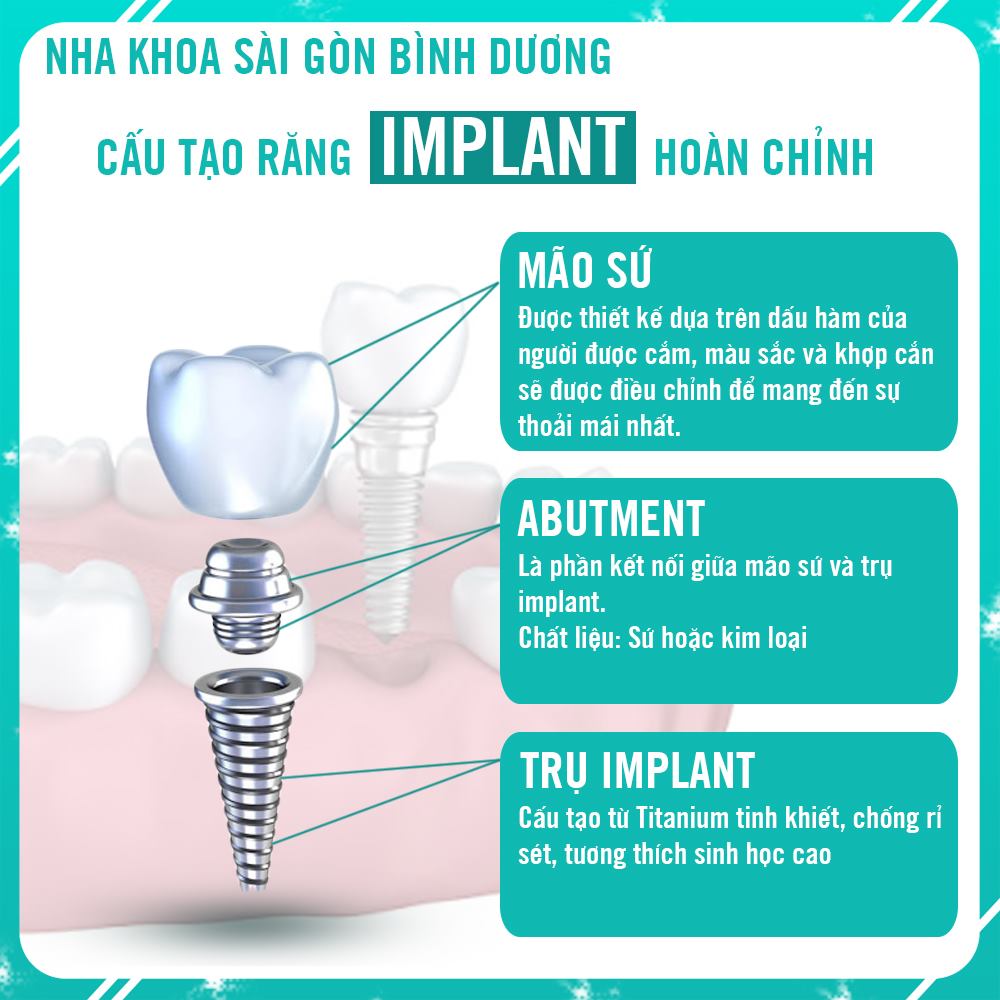 Cắm implant tại bình dương
