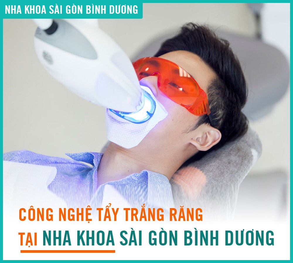 Tẩy trắng răng như thế nào để đẹp và an toàn ?