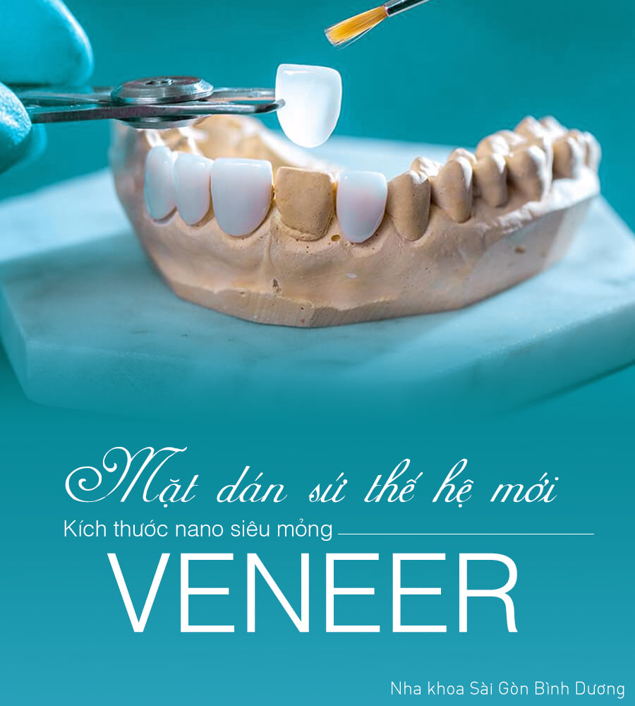 mặt dán sứ veneer giúp bảo tồn răng thật mặt dán sứ veneer giúp bảo tồn răng thật