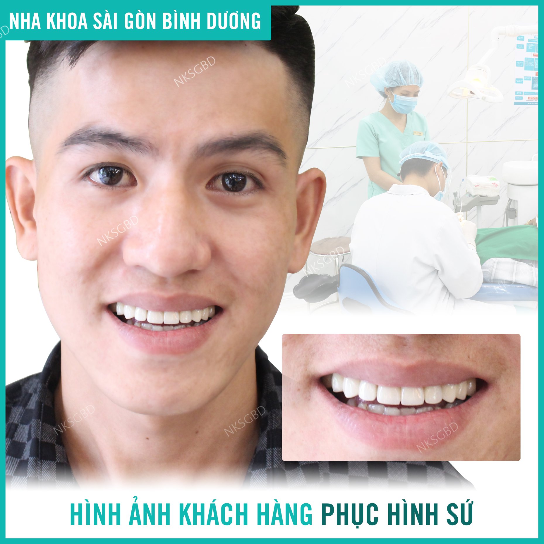 hình ảnh khách hàng bọc răng sứ tại nha khoa sài gòn hình ảnh khách hàng bọc răng sứ tại nha khoa sài gòn