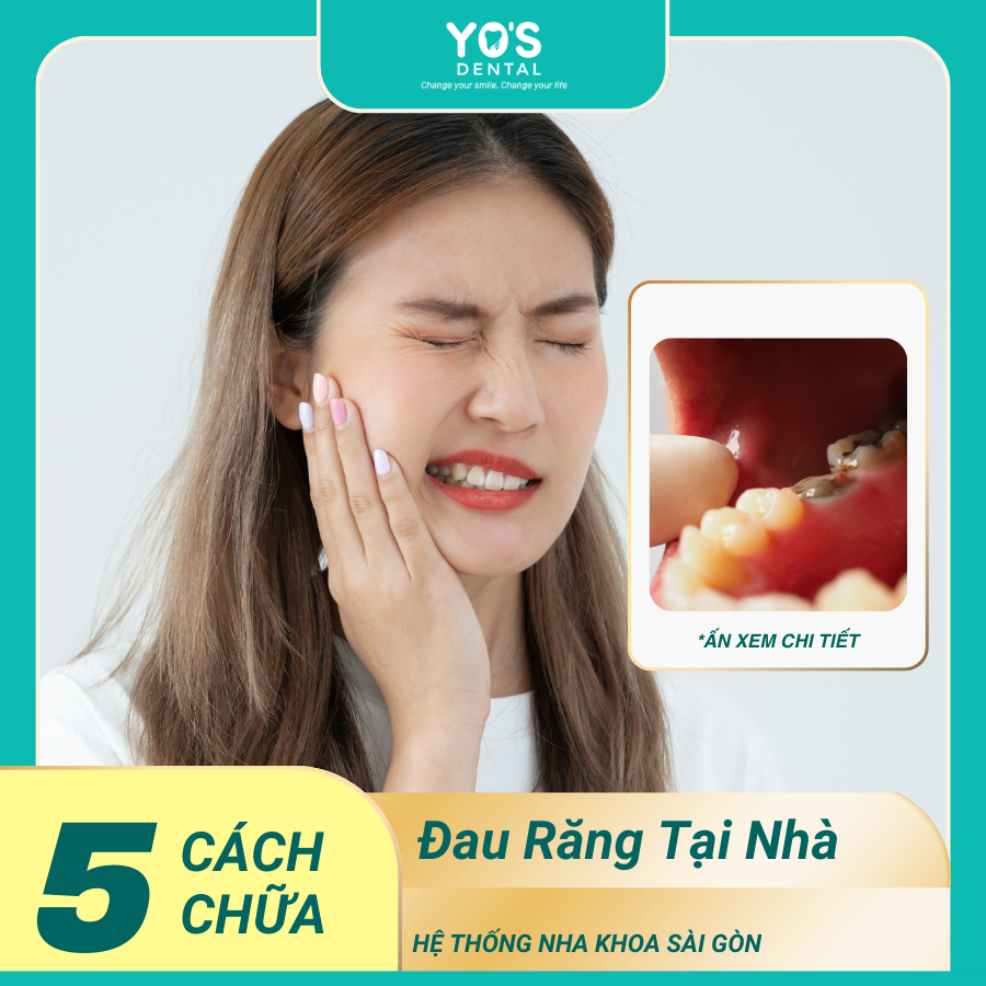 5 CÁCH CHỮA ĐAU RĂNG SÂU TẠI NHÀ HIỆU QUẢ NHANH<p class="custom-text-rate def-none"><img src="/wp-content/uploads/2025/05/Frame-66.png"></p>