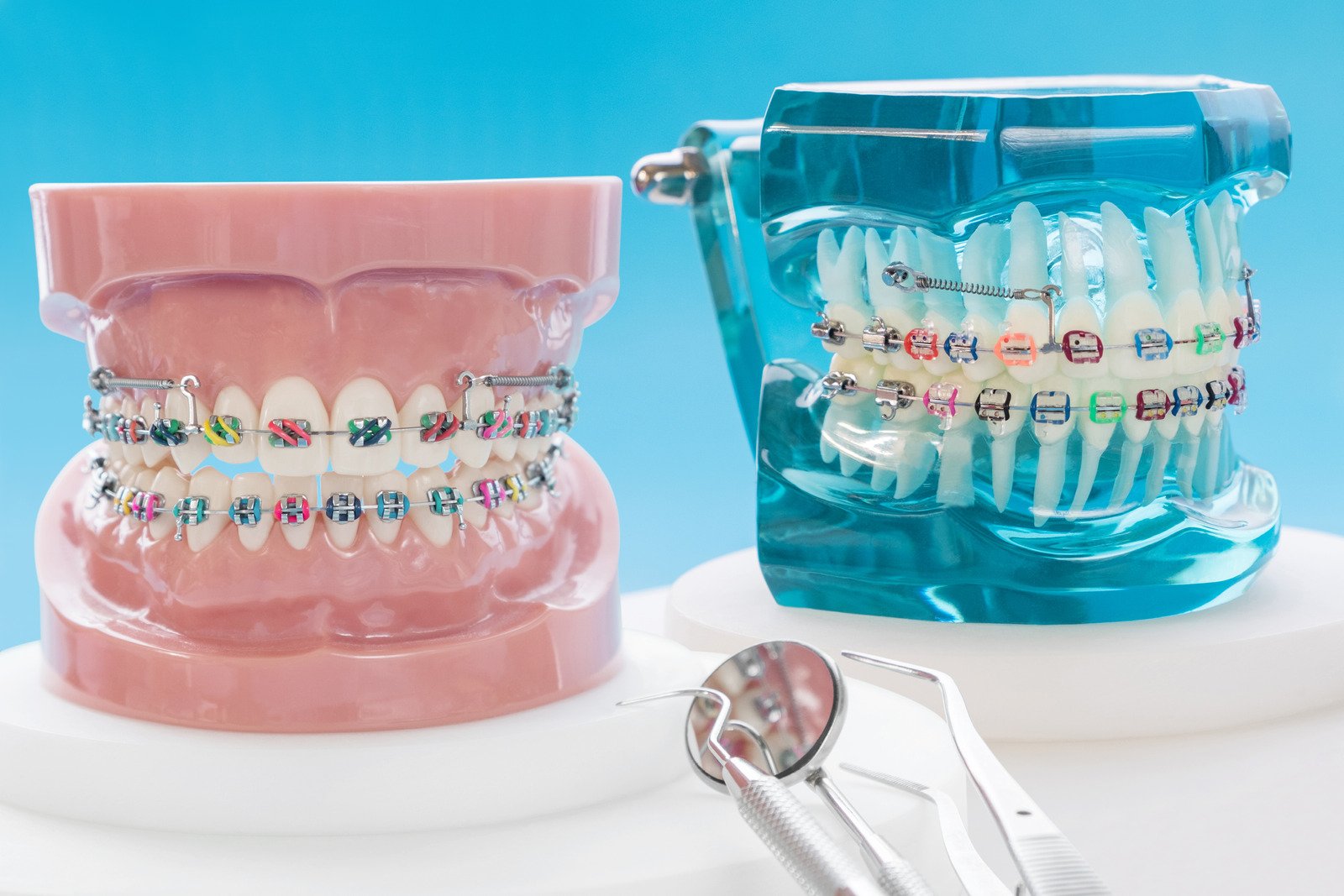 Khí cụ khi niềng răng Khí cụ khi niềng răng