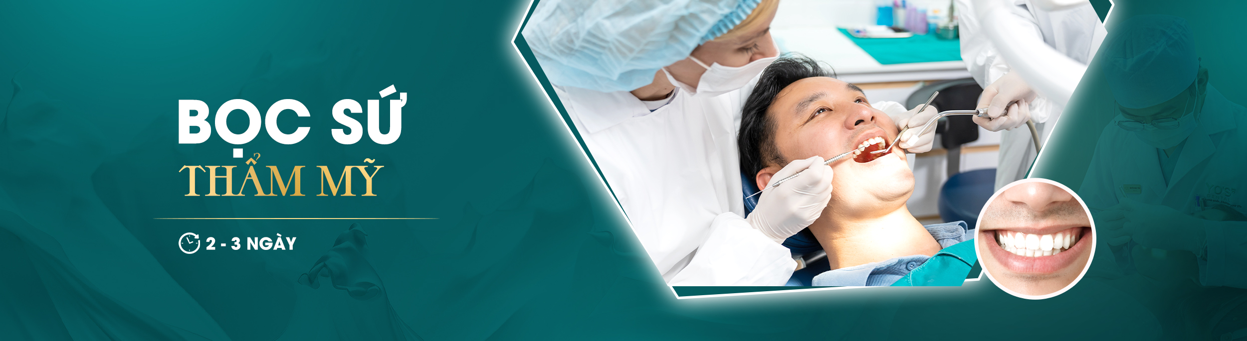 BỌC SỨ THẨM MỸ