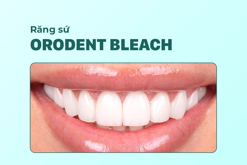 Răng sứ Orodent Bleach