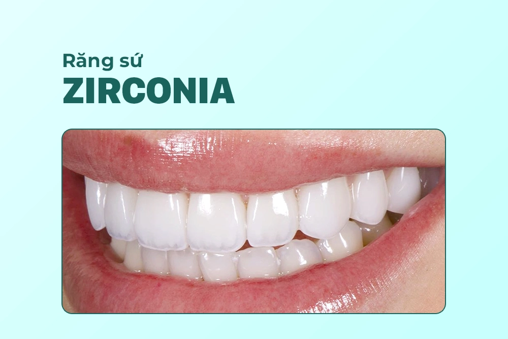 Răng sứ Zirconia