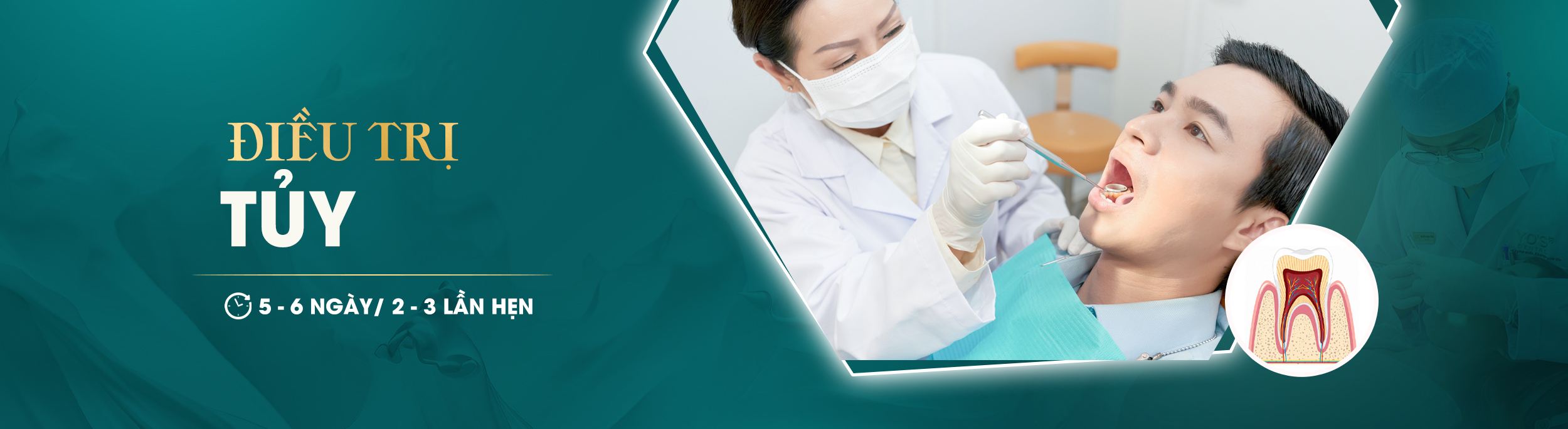 ĐIỀU TRỊ TUỶ