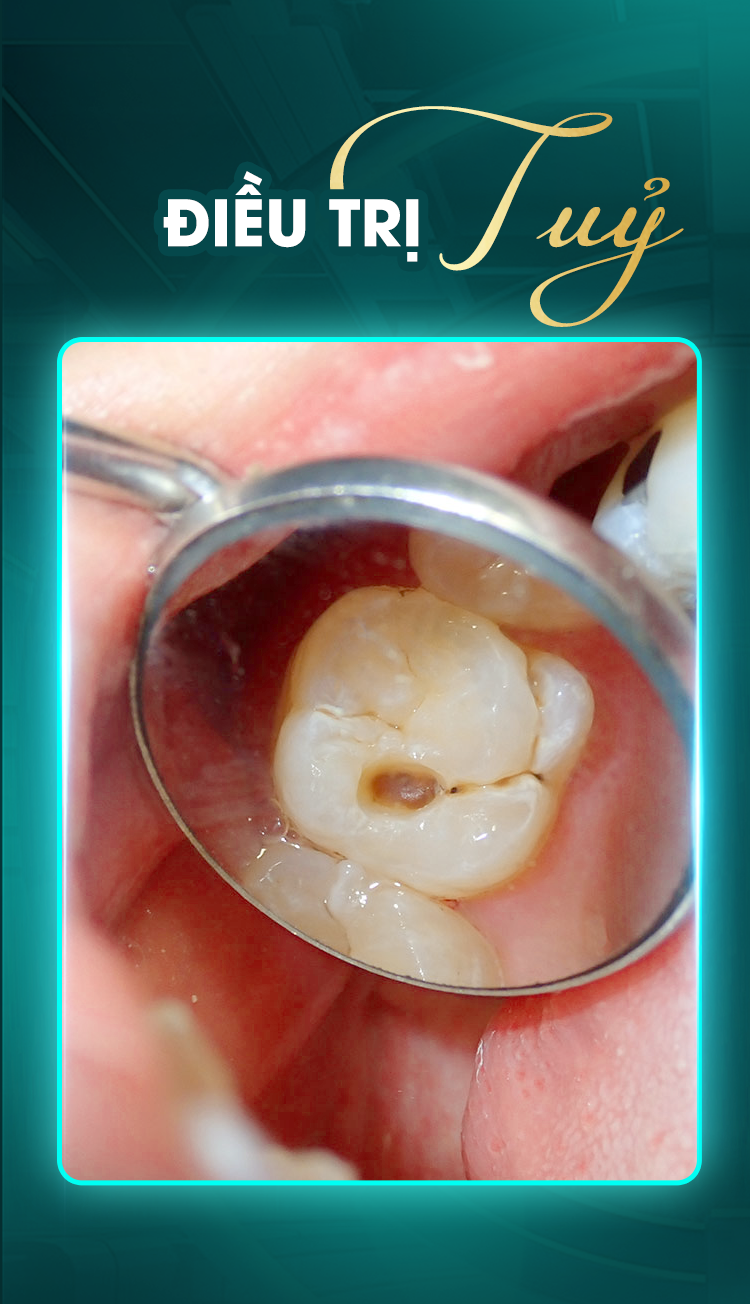 Nguyễn Thanh Tùng