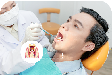 Điều trị tuỷ Điều trị tuỷ