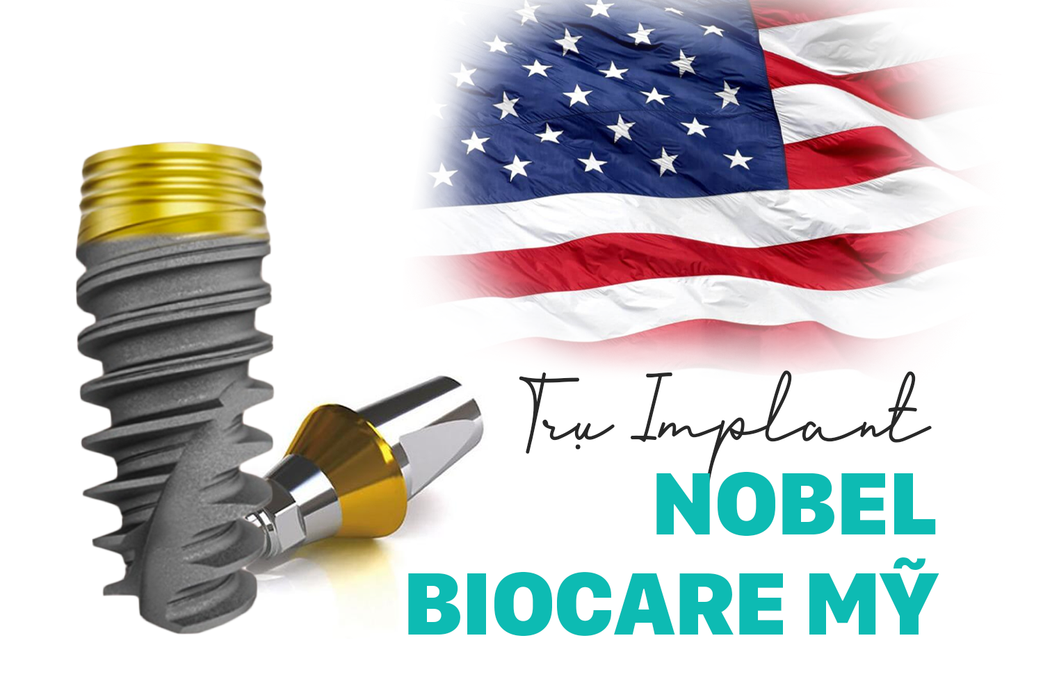 Trụ Noben Biocare Mỹ