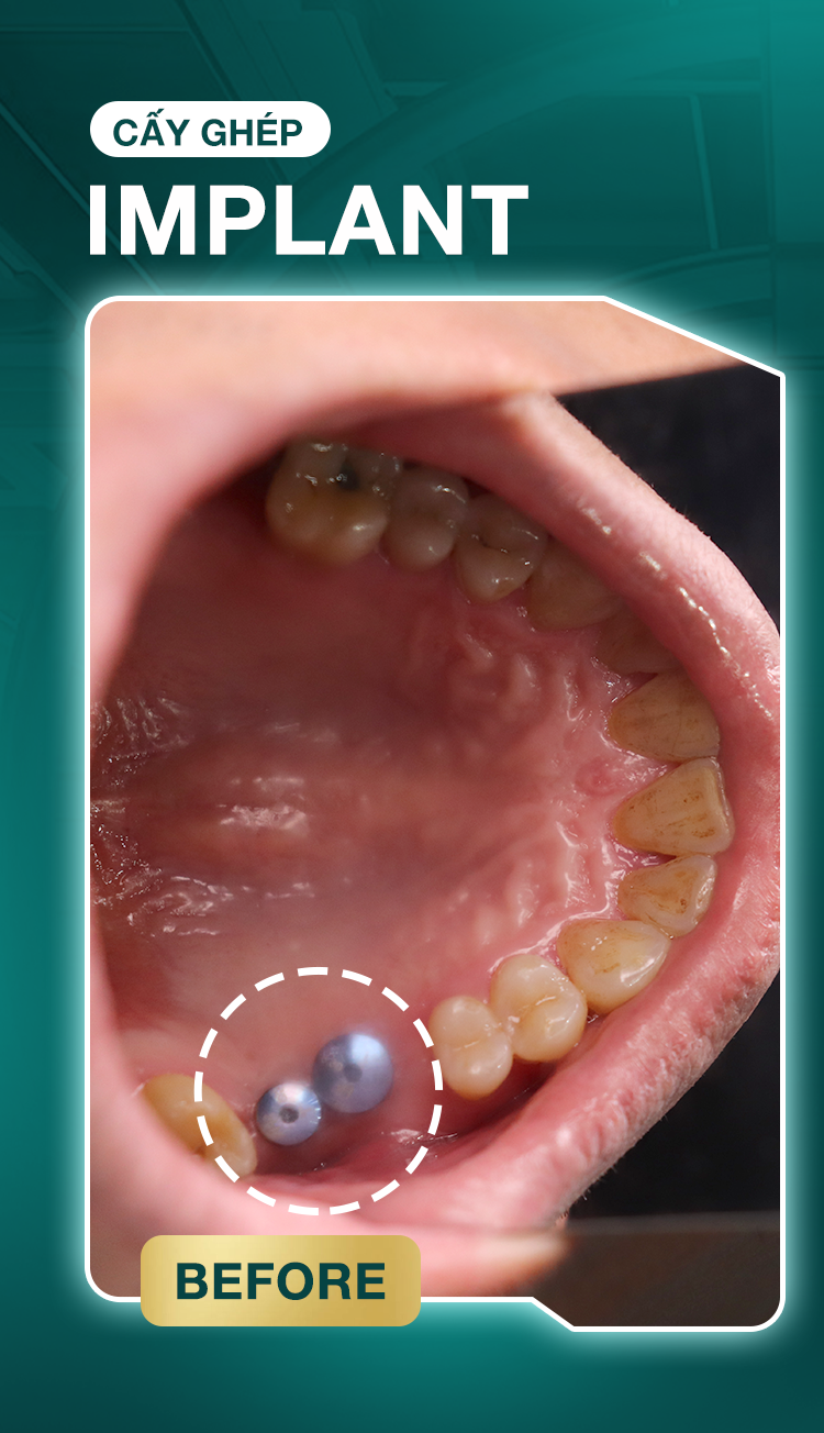 Châu Tích Huy Châu Tích Huy