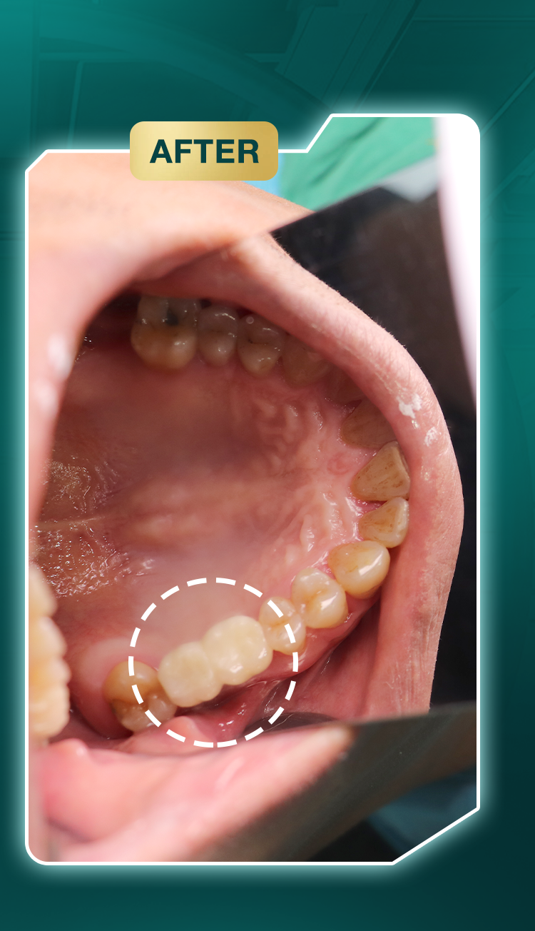 Châu Tích Huy Châu Tích Huy