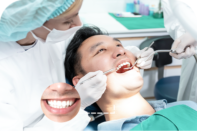 Mặt dán sứ Veneer Mặt dán sứ Veneer