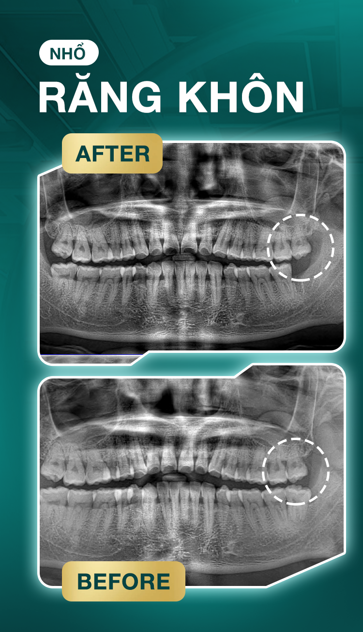 Lâm Tuấn Sơn Lâm Tuấn Sơn