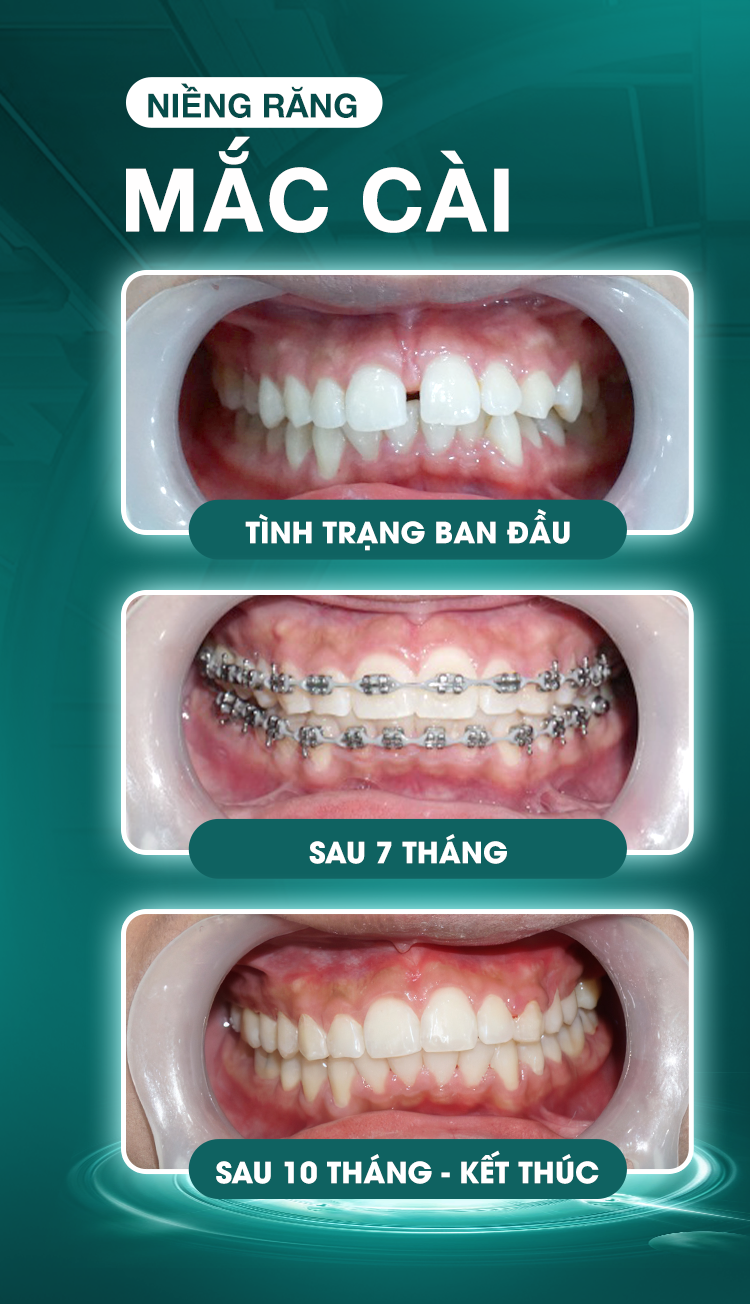 Lê Anh Tuấn Lê Anh Tuấn