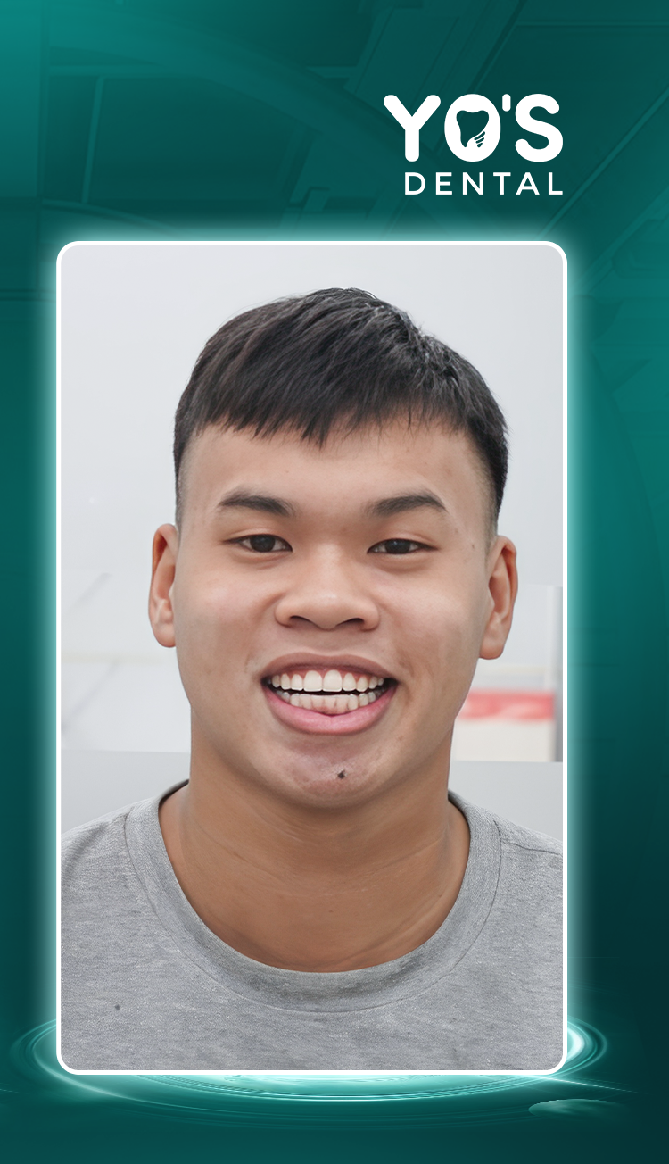 Lê Anh Tuấn Lê Anh Tuấn