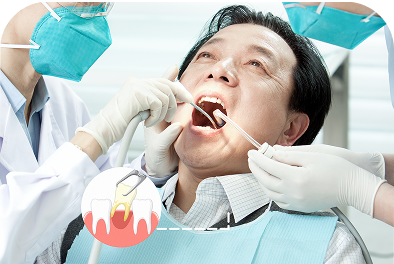 Nhổ răng Nhổ răng