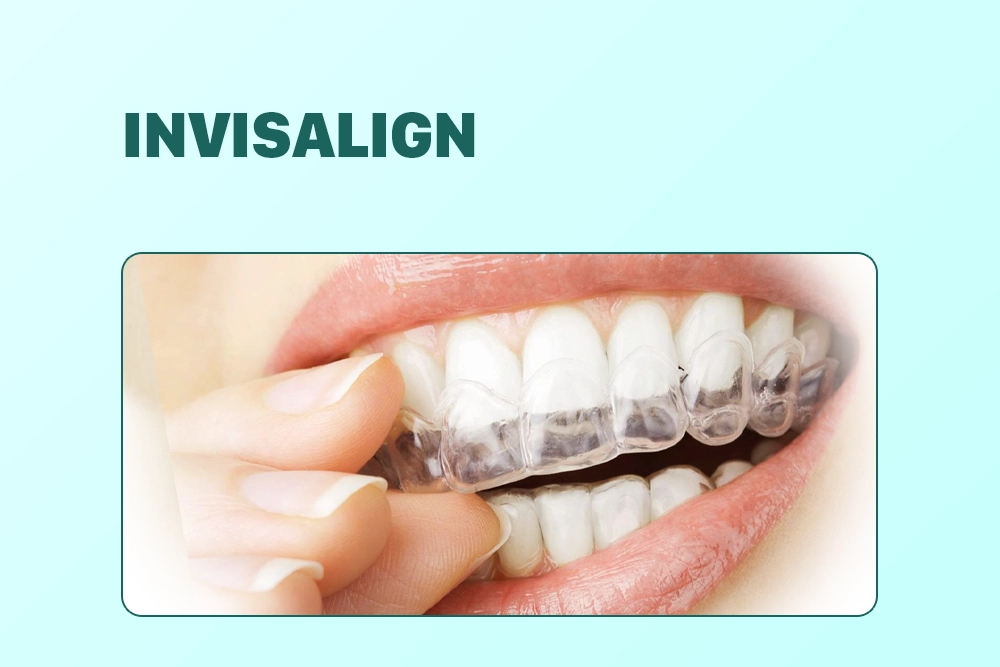Invisalign