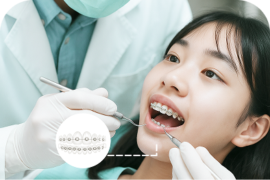 Niềng răng Niềng răng