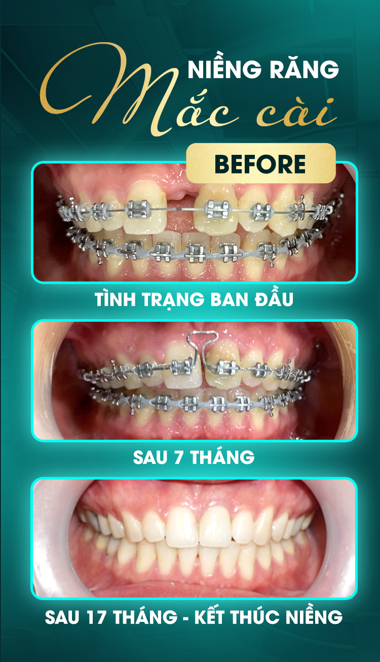 Trần Phương Uyên