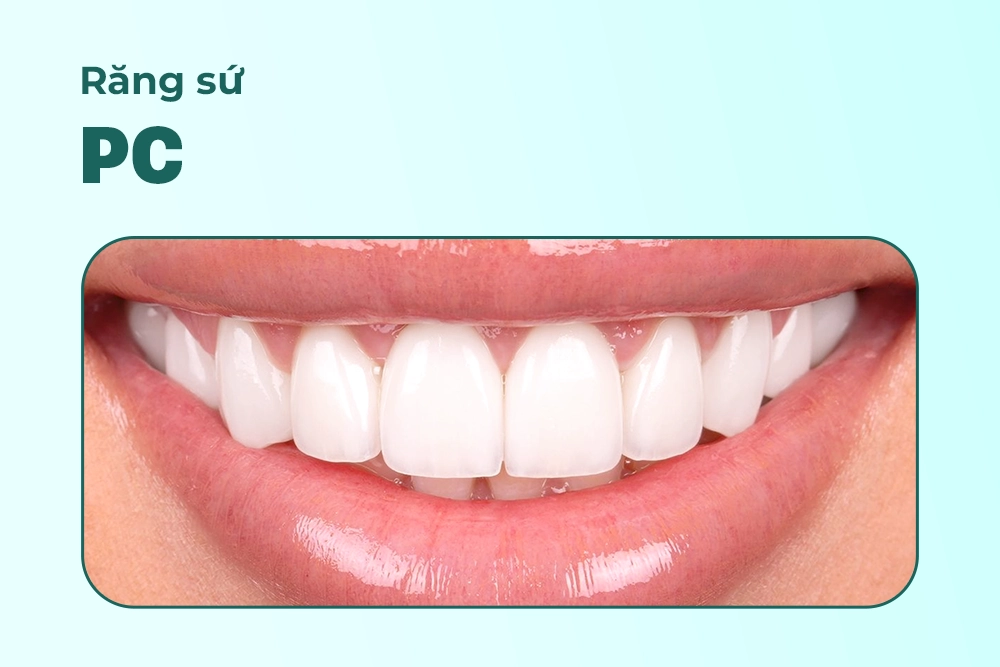Răng sứ PC