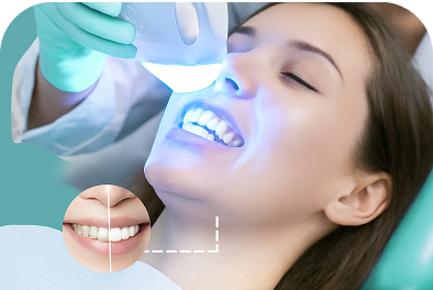 Tẩy trắng răng Tẩy trắng răng